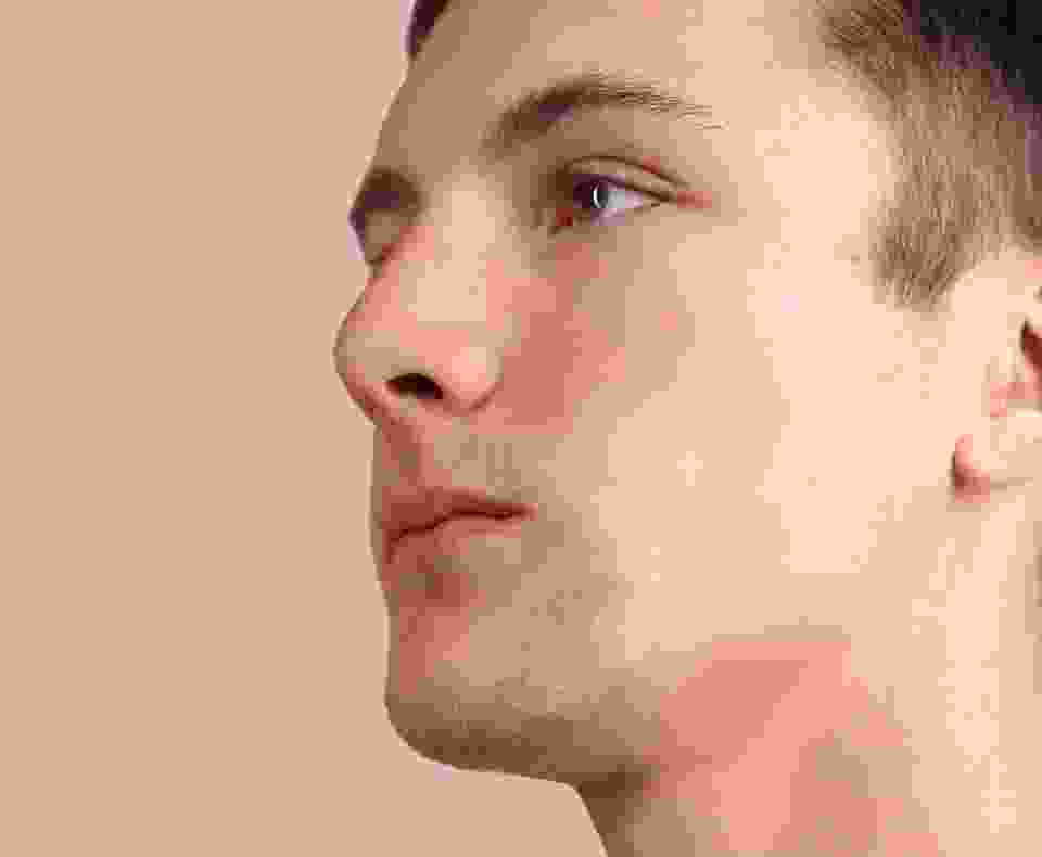 After view of a man’s cheek in the skin comparison