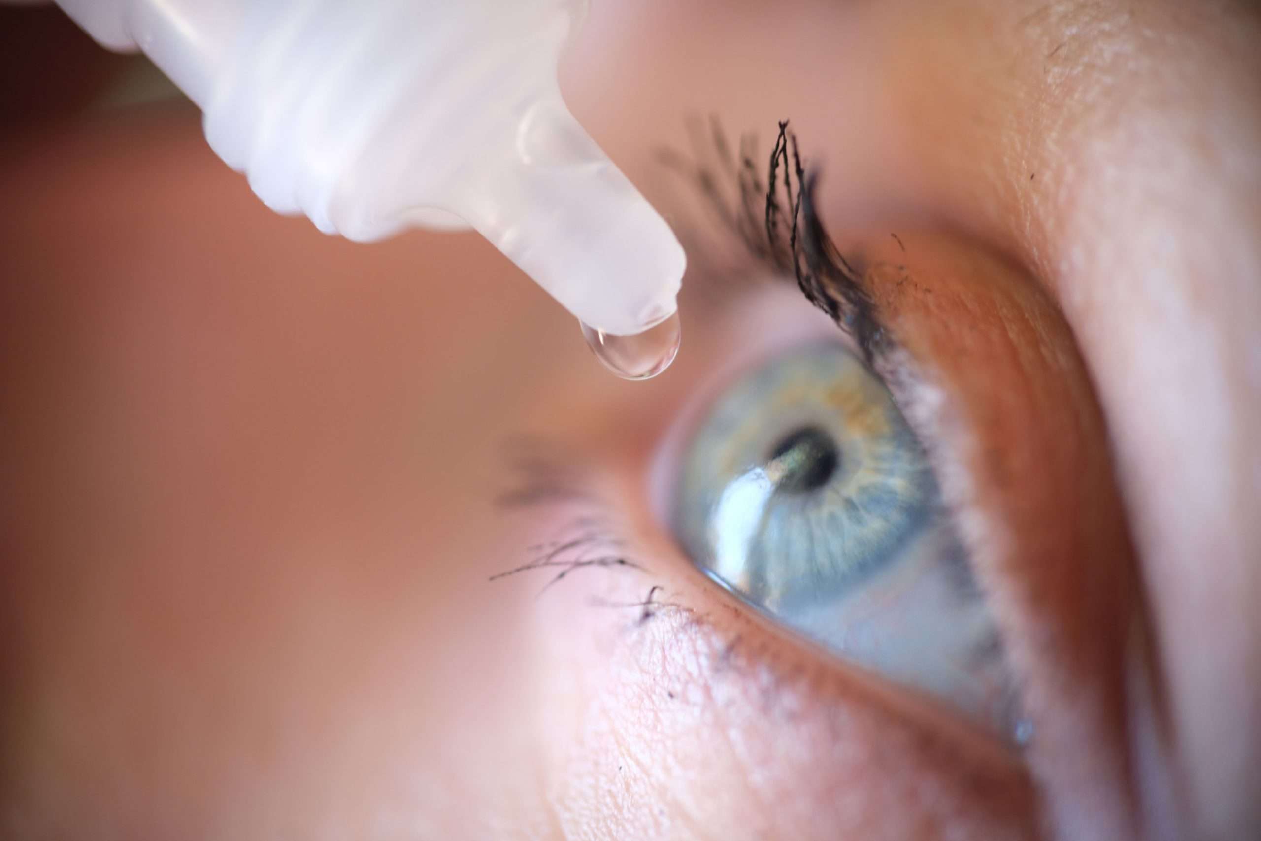 Close-up of an eye with a drop forming at the tip of an eye-drop bottle