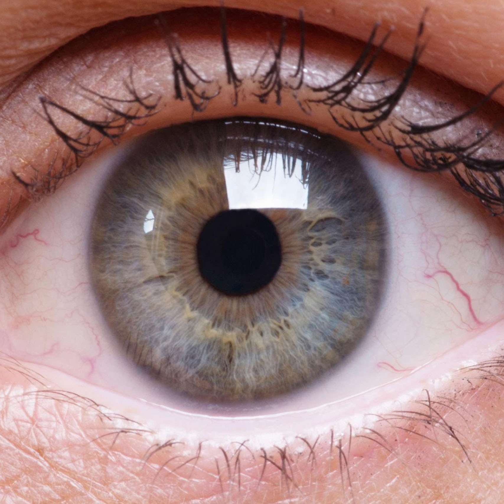 Dry eyes treatment information