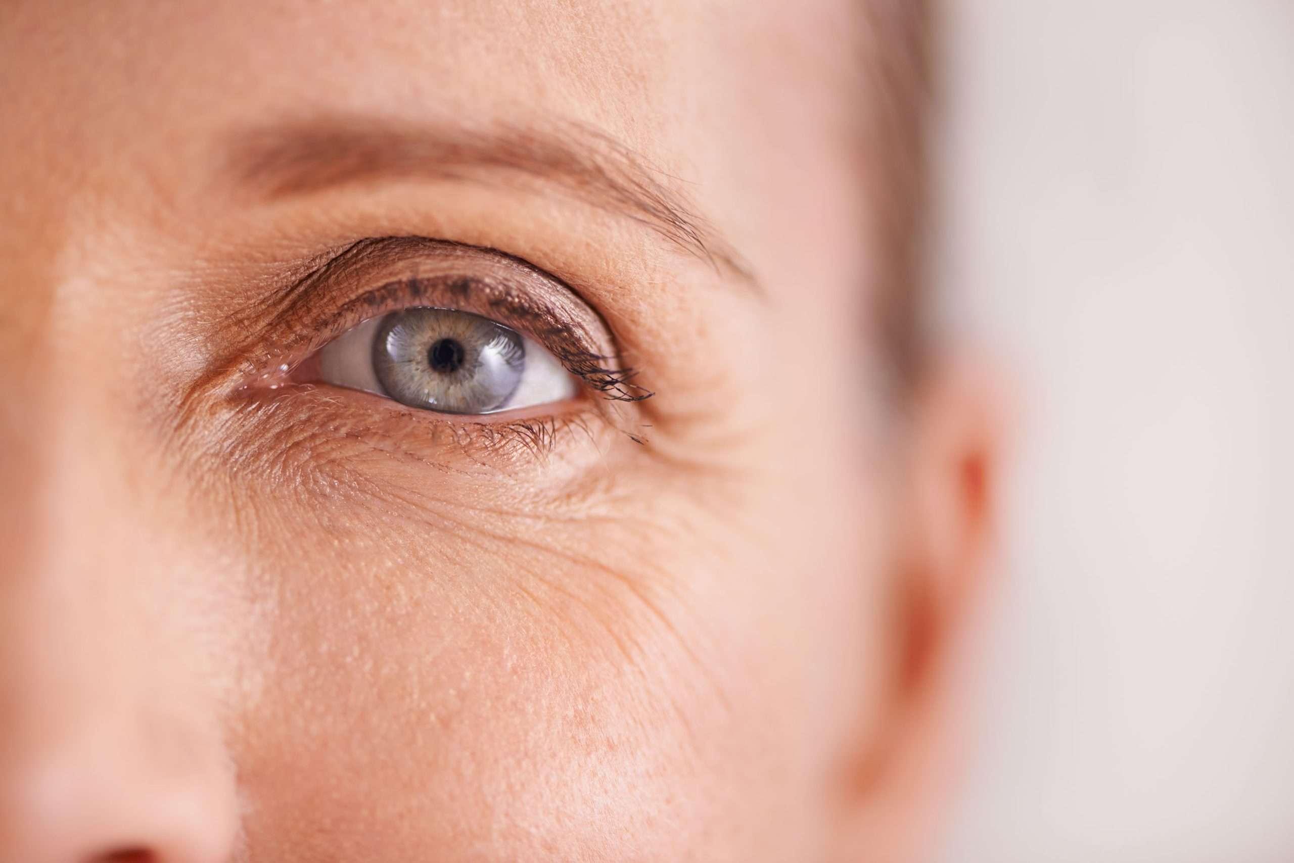 Close-up of fine lines around the outer corner of an eye