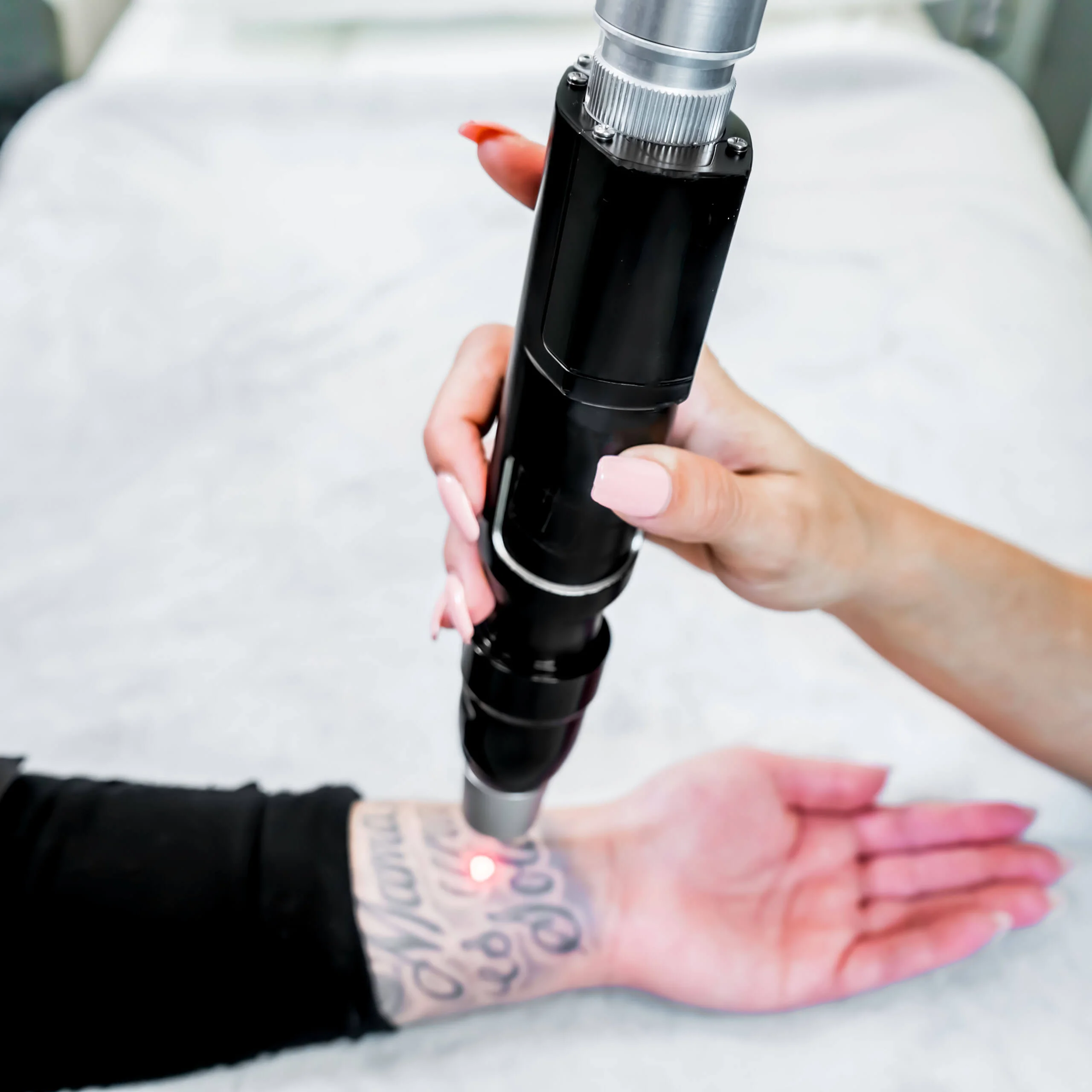 Tattoo removal services