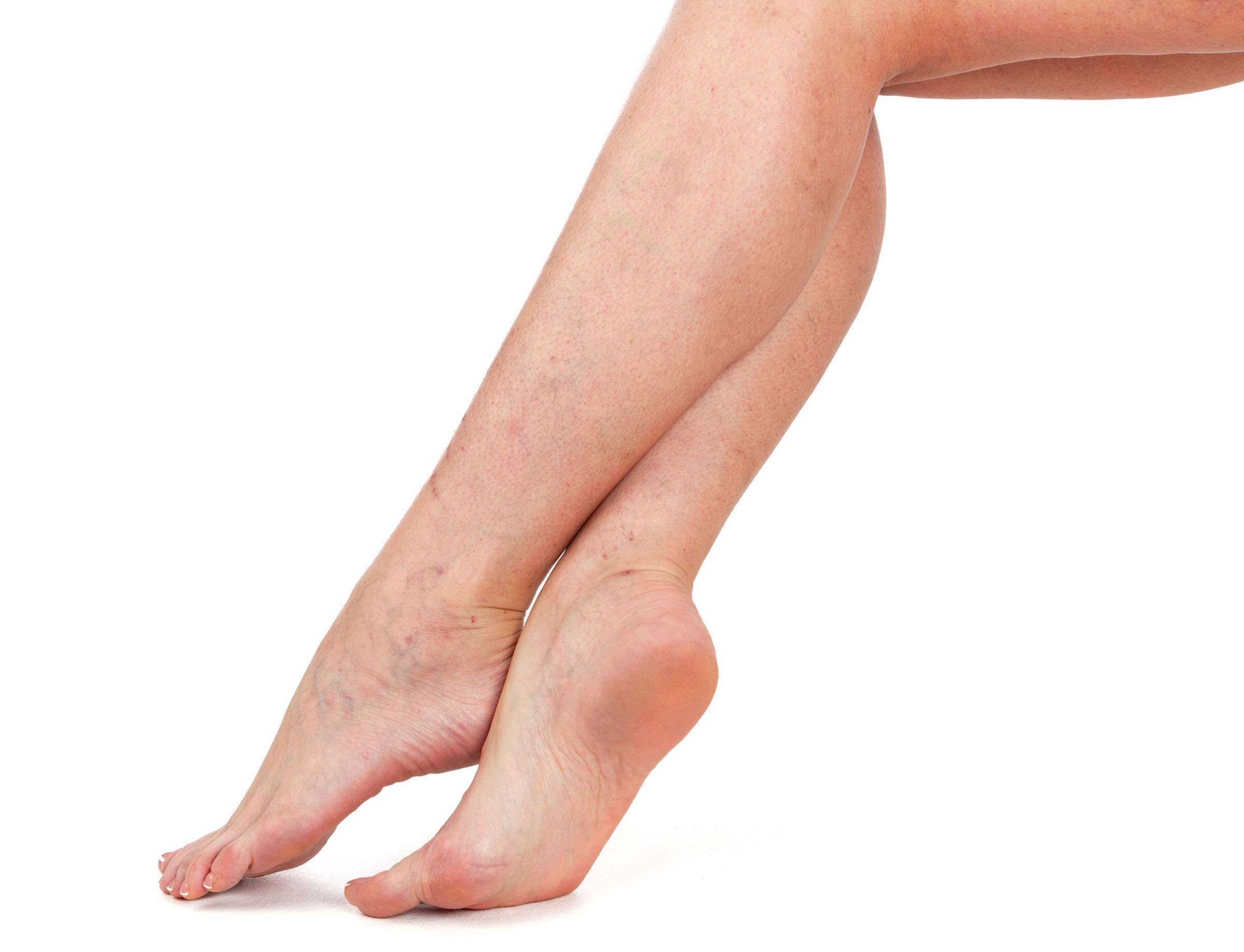 Crossed lower legs with small visible veins around the ankles