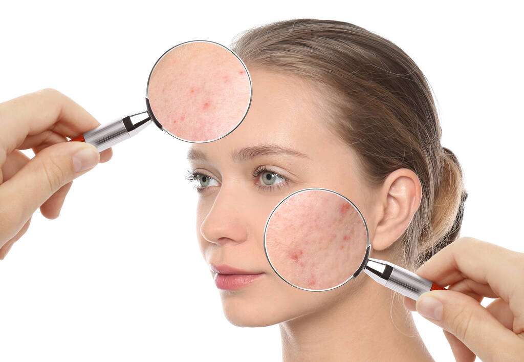 Magnifying glasses highlighting spots and texture on a woman’s forehead and cheek